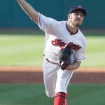 Trevor Bauer