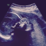 Kayla Wallace Isaiah Thomas