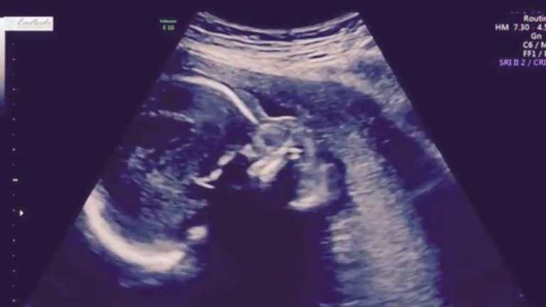 Kayla Wallace Isaiah Thomas