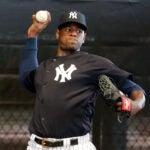 Luis Severino Yankees MLB