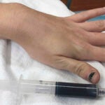 New England Journal of Medicine