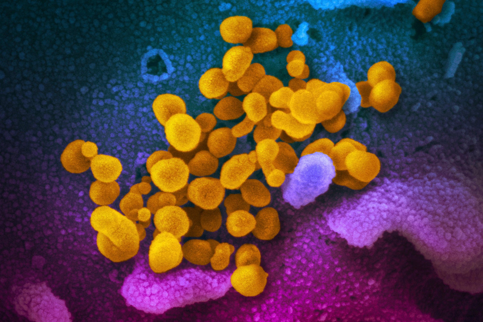 Here's What You Need To Know About COVID-19 Variants BA.4 And BA.5