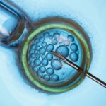 In vitro fertilization.