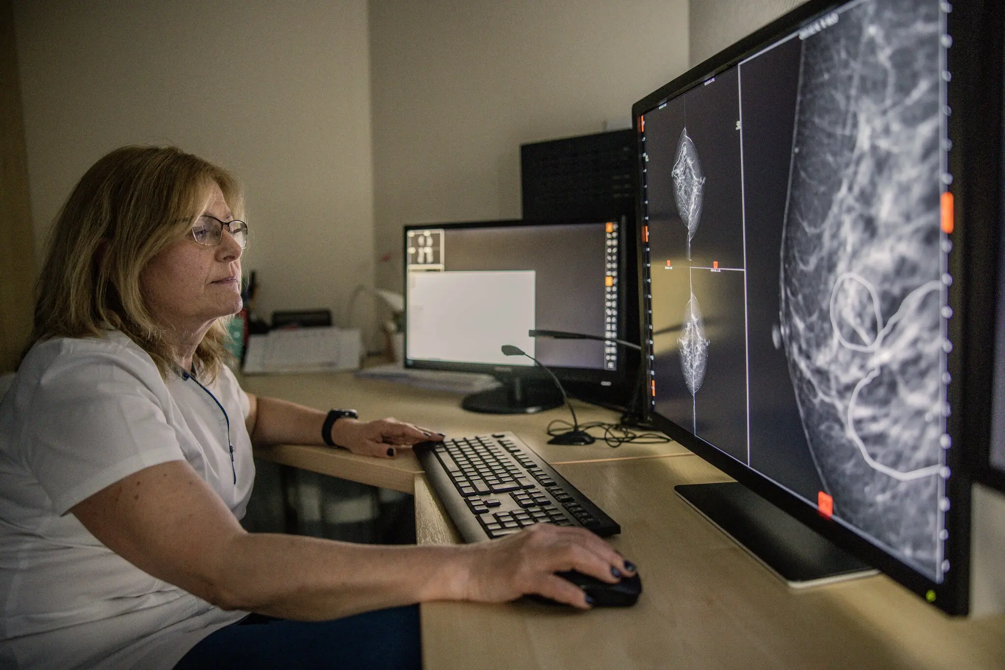 Dr. Éva Ambrózay, a radiologist at Bács-Kiskun County Hospital, looks at a computer screen displaying a cancer scan.