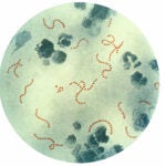 This illustration depicts a photomicrographic view of Streptococcus pyogenes bacteria
