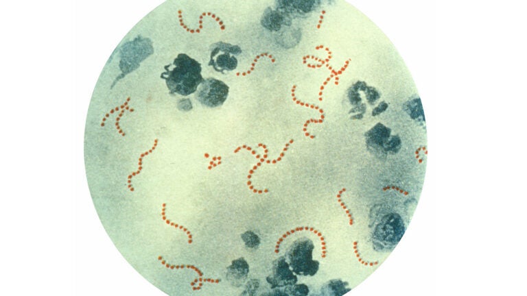 This illustration depicts a photomicrographic view of Streptococcus pyogenes bacteria