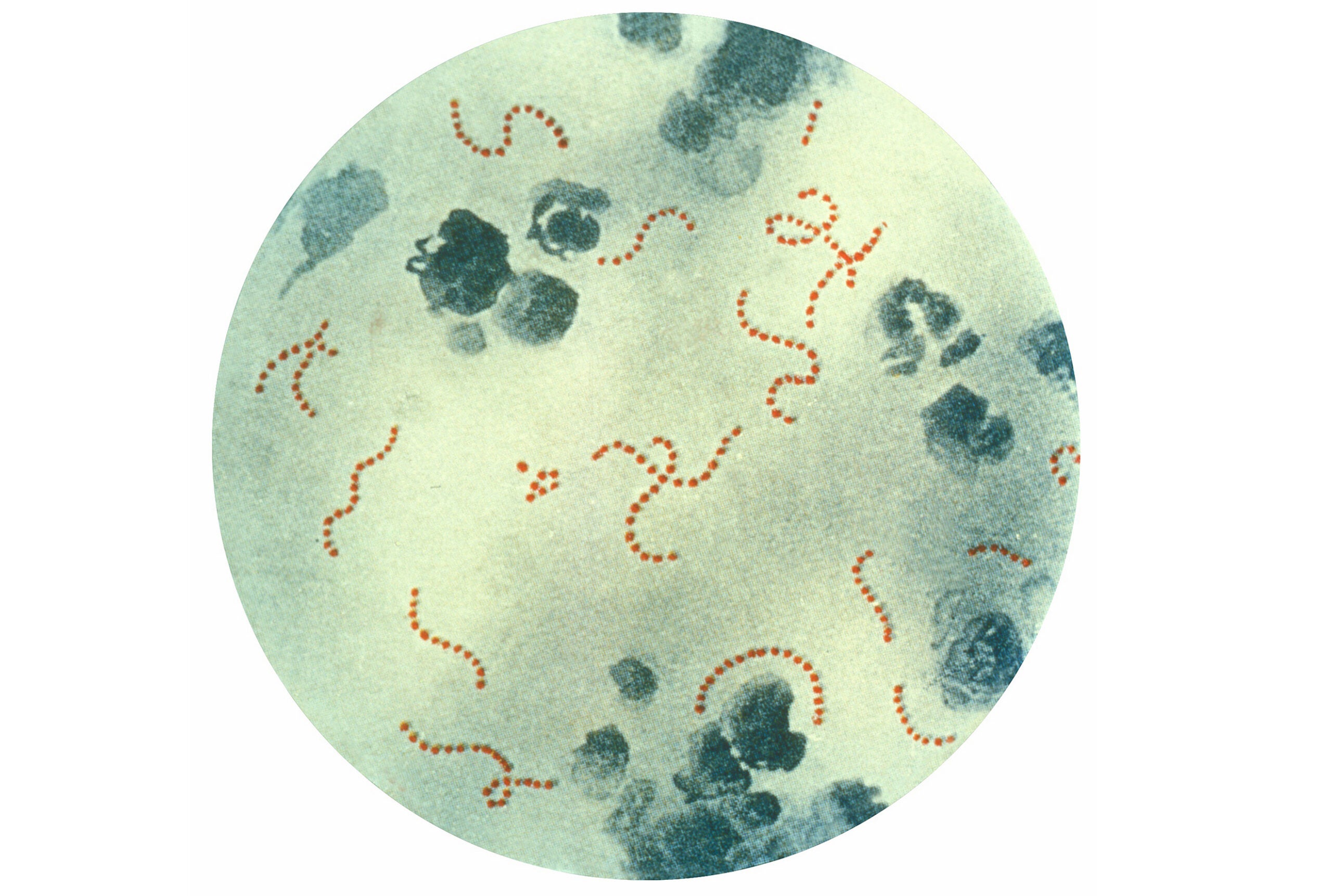 This illustration depicts a photomicrographic view of Streptococcus pyogenes bacteria