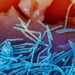 RSV virions, colorized blue, and anti-RSV F protein/gold antibodies, colorized yellow, shedding from the surface of human lung cells.