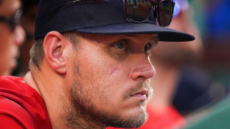 Severity of Red Sox pitcher Tanner Houck's injury after scary line