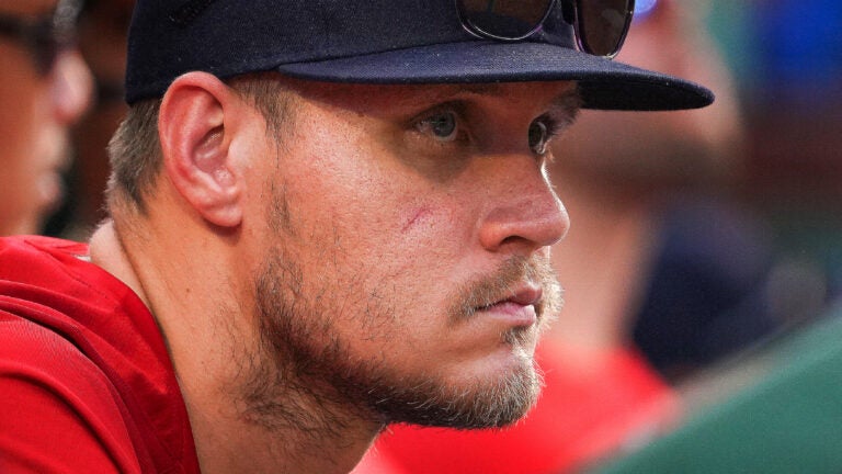 Boston Red Sox pitcher Tanner Houck (89), with only a small scar showing on his cheek, watches from the dugout during the eighth inning. The Boston Red Sox host the Oakland Athletics on July 8, 2023 at Fenway Park in Boston, MA.