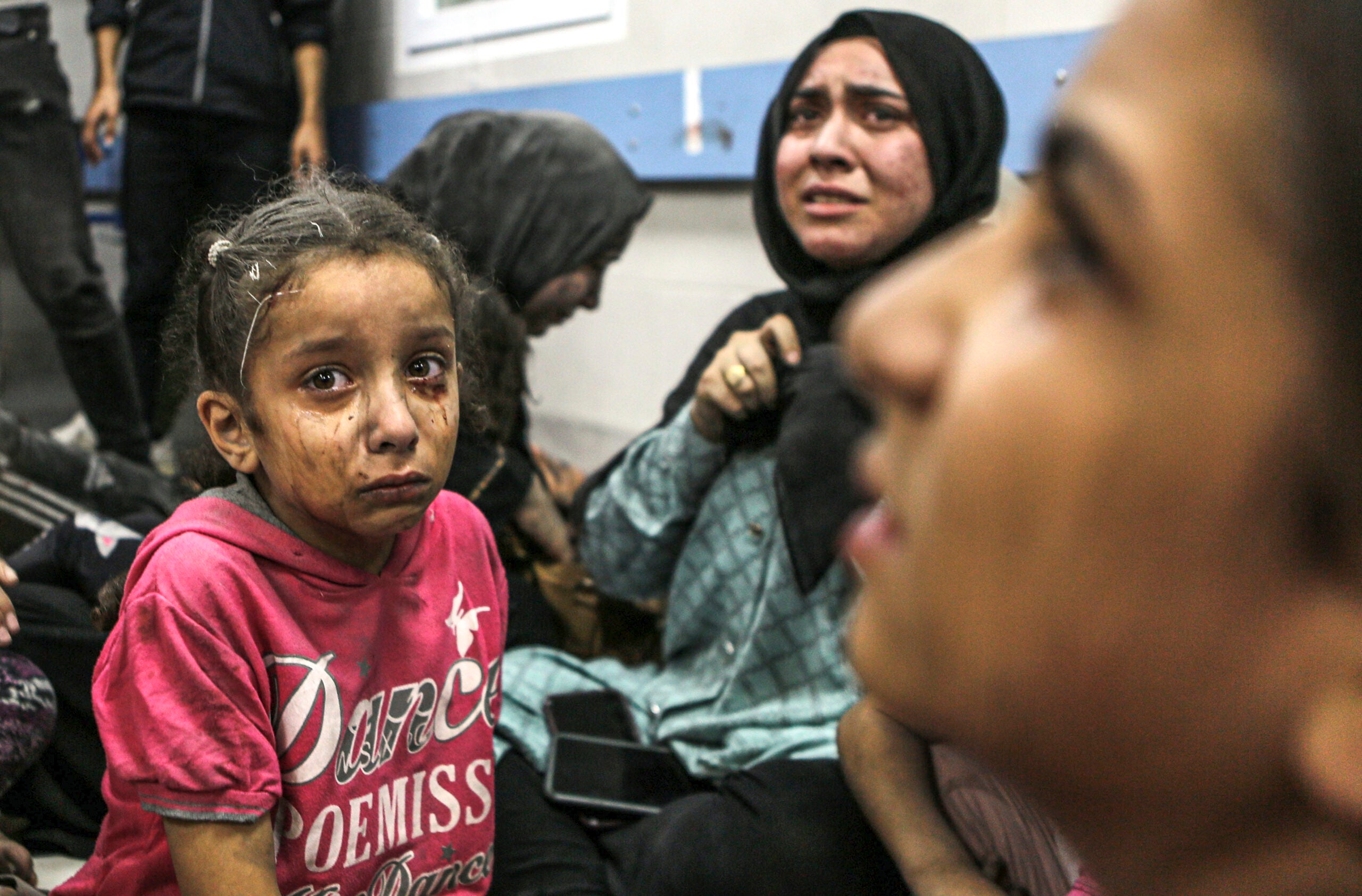 Wounded Palestinians sit in al-Shifa hospital in Gaza City, central Gaza Strip.