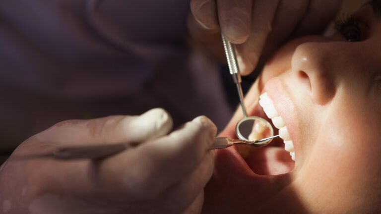 Minnesota woman sues dentist after 4 root canals, 8 dental crowns, and 20 fillings in a single visit - Vimarsana News