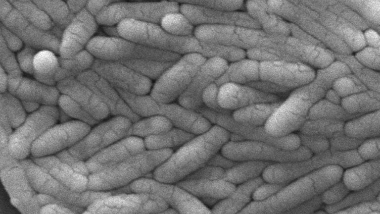 A large group of Gram-negative Salmonella typhimurium bacteria.