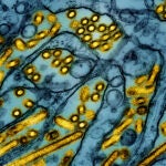 FILE -This colorized electron microscope image released by the National Institute of Allergy and Infectious Diseases on March 26, 2024, shows avian influenza A H5N1 virus particles (yellow), grown in Madin-Darby Canine Kidney (MDCK) epithelial cells (blue).