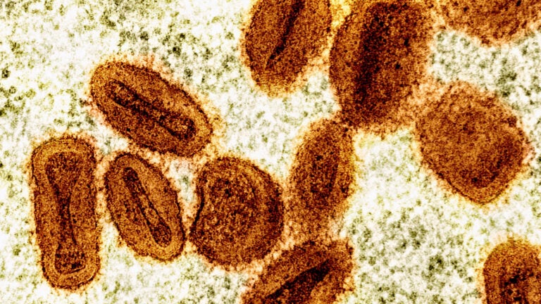 2 mpox cases confirmed in Worcester as Mass. health officials warn of 'concerning' uptick