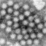 Norovirus is the suspected cause of an outbreak that has led a Medford school to be closed two days in a row.