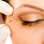 Local News South Shore spa owner pleads guilty to administering illegal injections that caused severe botulism