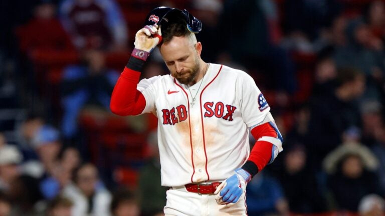 Red Sox place Trevor Story on IL with sports hernia, contemplating surgery Red Sox place Trevor Story on IL with sports hernia, contemplating surgery