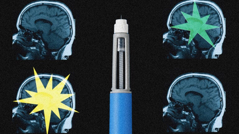 Ozempic may be reshaping the brain, scientists say