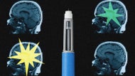 Ozempic may be reshaping the brain, scientists say