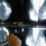 Local News Mass. high school to undergo testing after several female teachers diagnosed with breast cancer